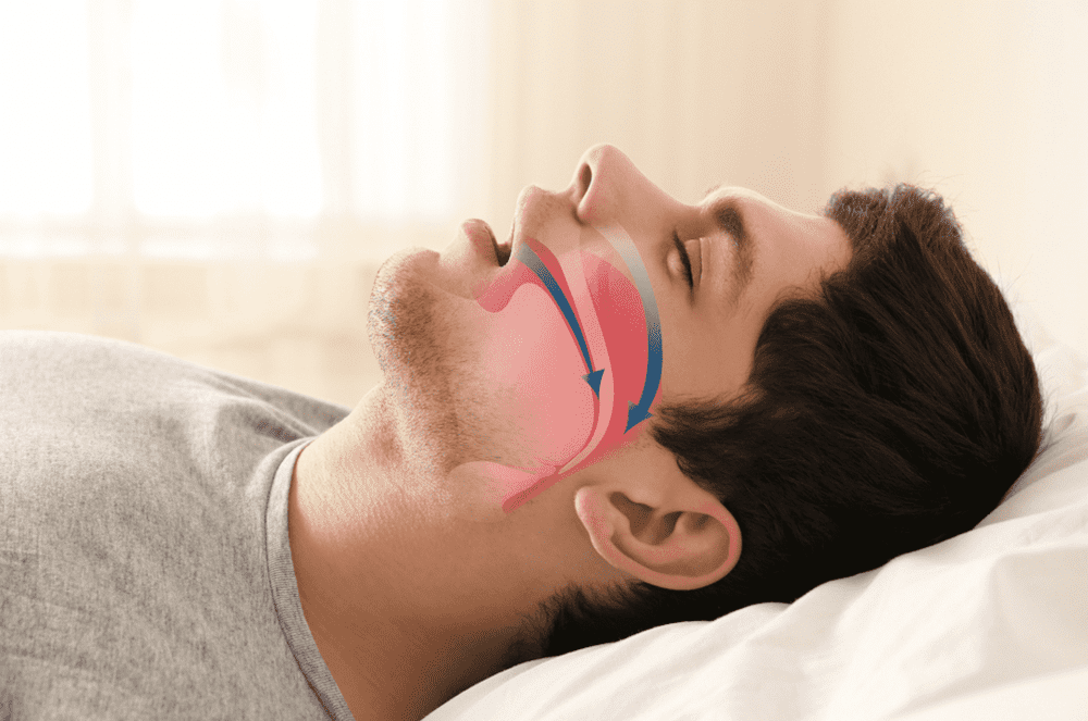 Discover How Technology Can Help With Sleep Apnea