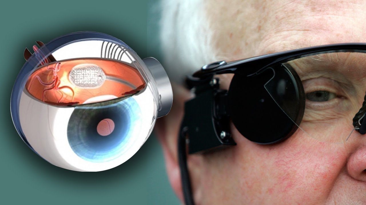 Bionic Eye Tech - Learn About This Technology